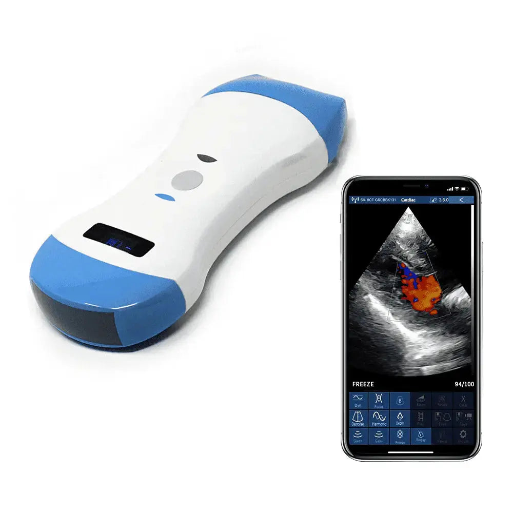 Wireless portable ultrasound machine. Linear/Convex/Phased Array Probe 3 in 1 Pocket Ultrasound