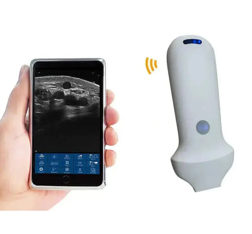 High Frequency Linear_Wireless_Probe_Type_Ultrasound_Scanner