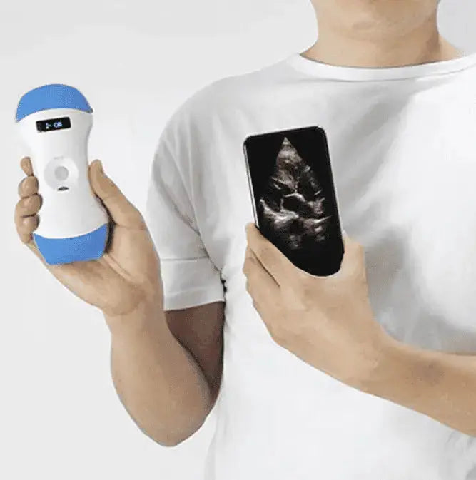 Portable Ultrasound. Point-of-care imaging in the palm of your hand